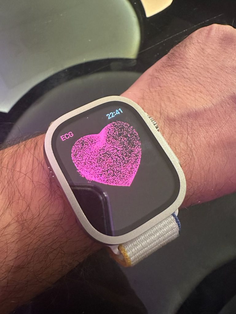 Apple-Watch-Ultra
